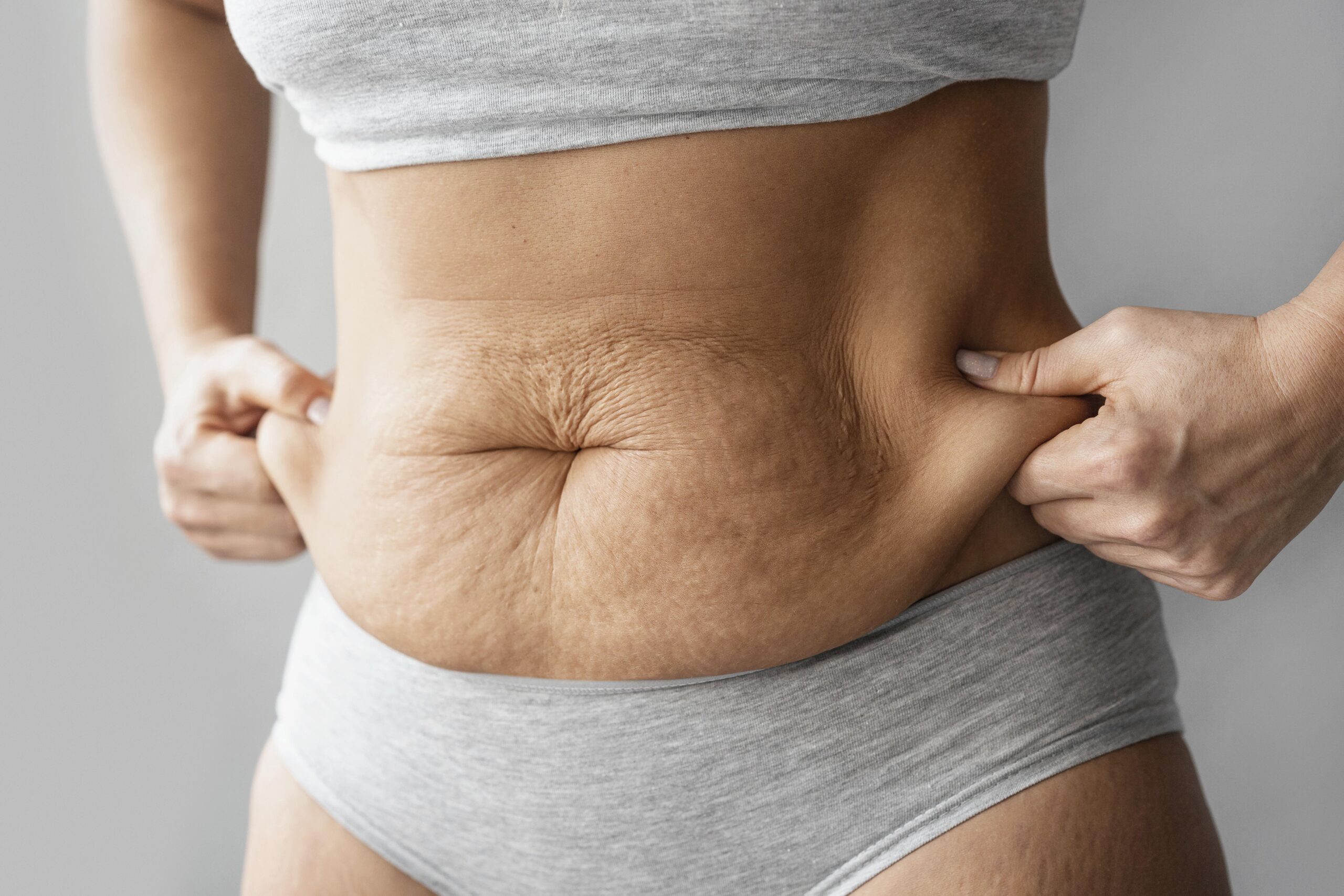 Leptin and Weight Loss: Is It Possible to Enhance This Hormone to Lose Weight?